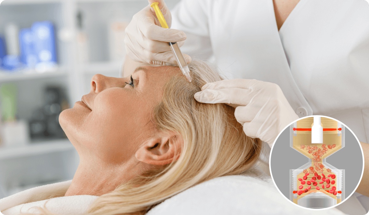 Laser+PRP Supercharge your hair regrowth
